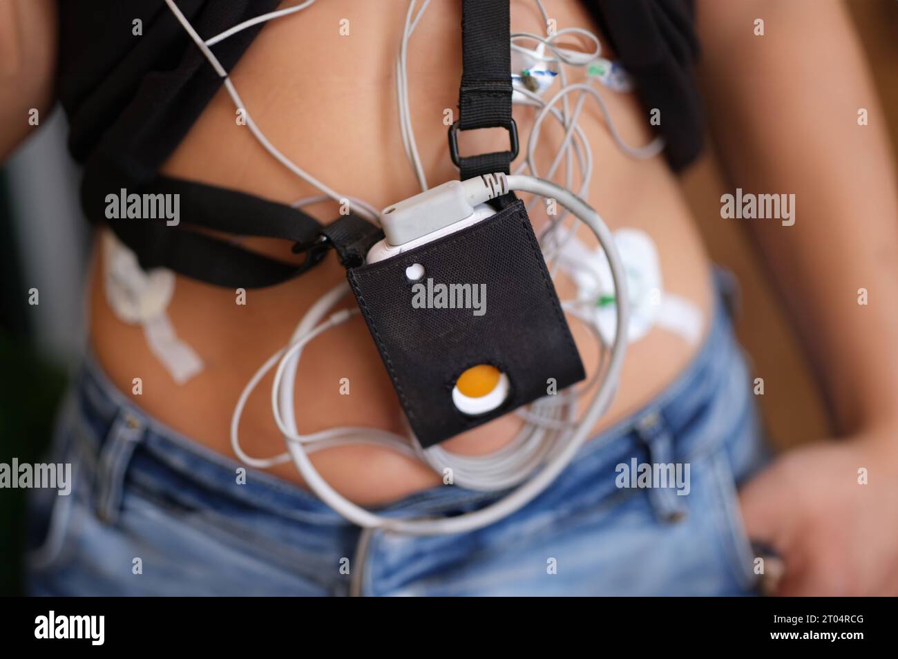 Der EKG-holter-Monitor hängt in Nahaufnahme am Körper des Patienten Stockfoto