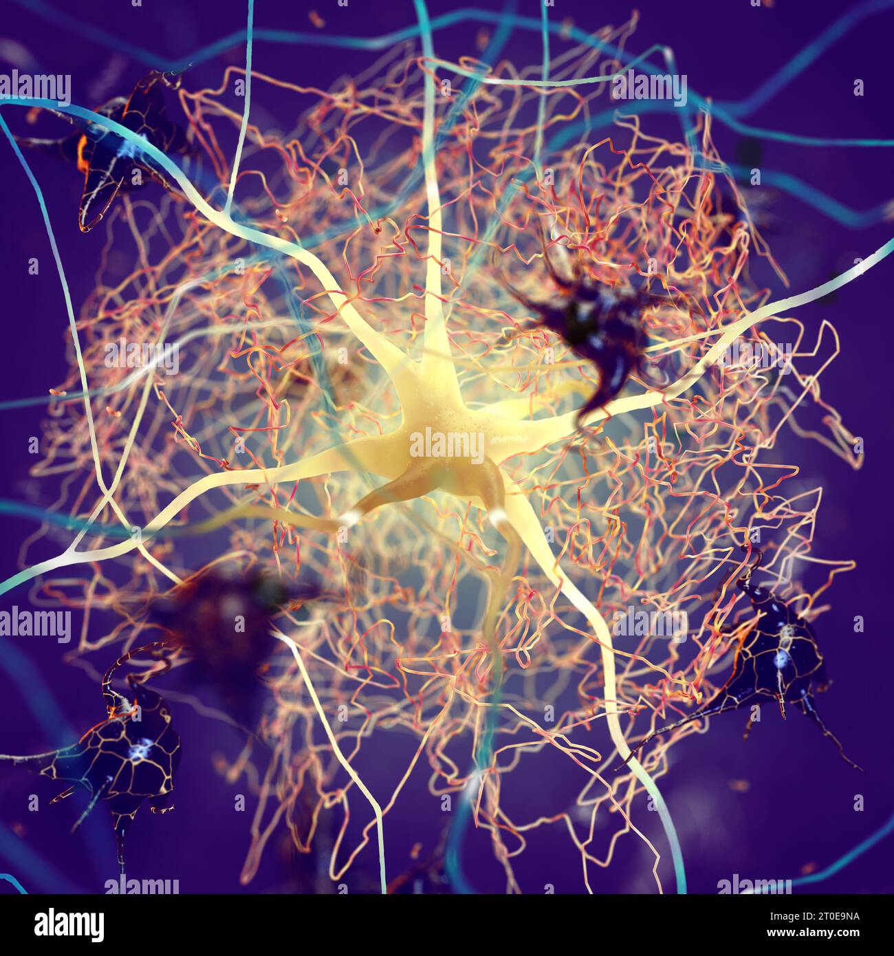 Amyloid Plaques bilden sich zwischen Neuronen. Beta-Amyloid-Protein, das Nervenzellen stört, funktioniert in einem Gehirn mit Alzheimer-Krankheit Stockfoto