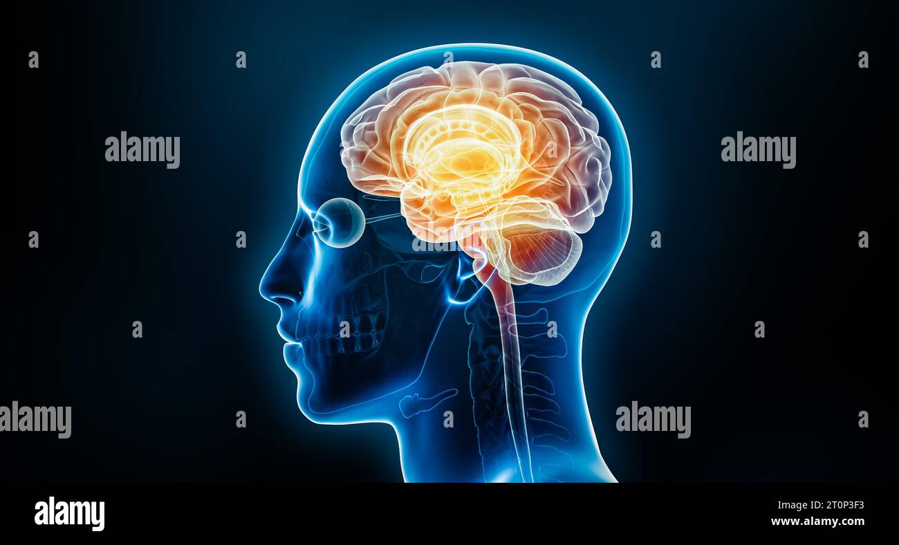 3D-Darstellung der neuronalen Aktivität oder Entzündung des menschlichen Gehirns mit dem Körper. Anatomie, neurologische Erkrankung, Kopfschmerzen, Intelligenz, Medizin, Stockfoto