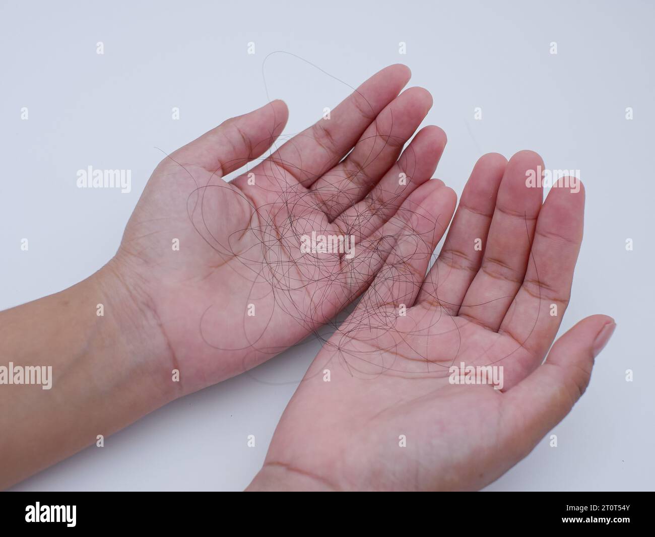 Nahaufnahme einer Hand, die Haarausfall hält. Angst durch Haarausfall Stockfoto