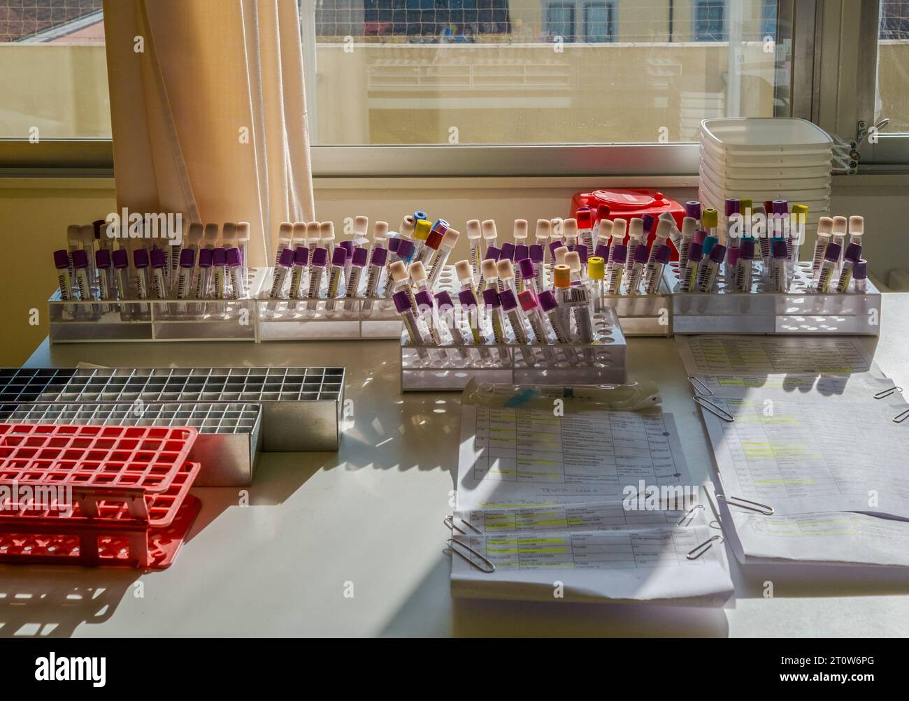 Sonnenstrahlen auf dem Tisch mit Blutteströhrchen in einer onkologischen Abteilung Stockfoto