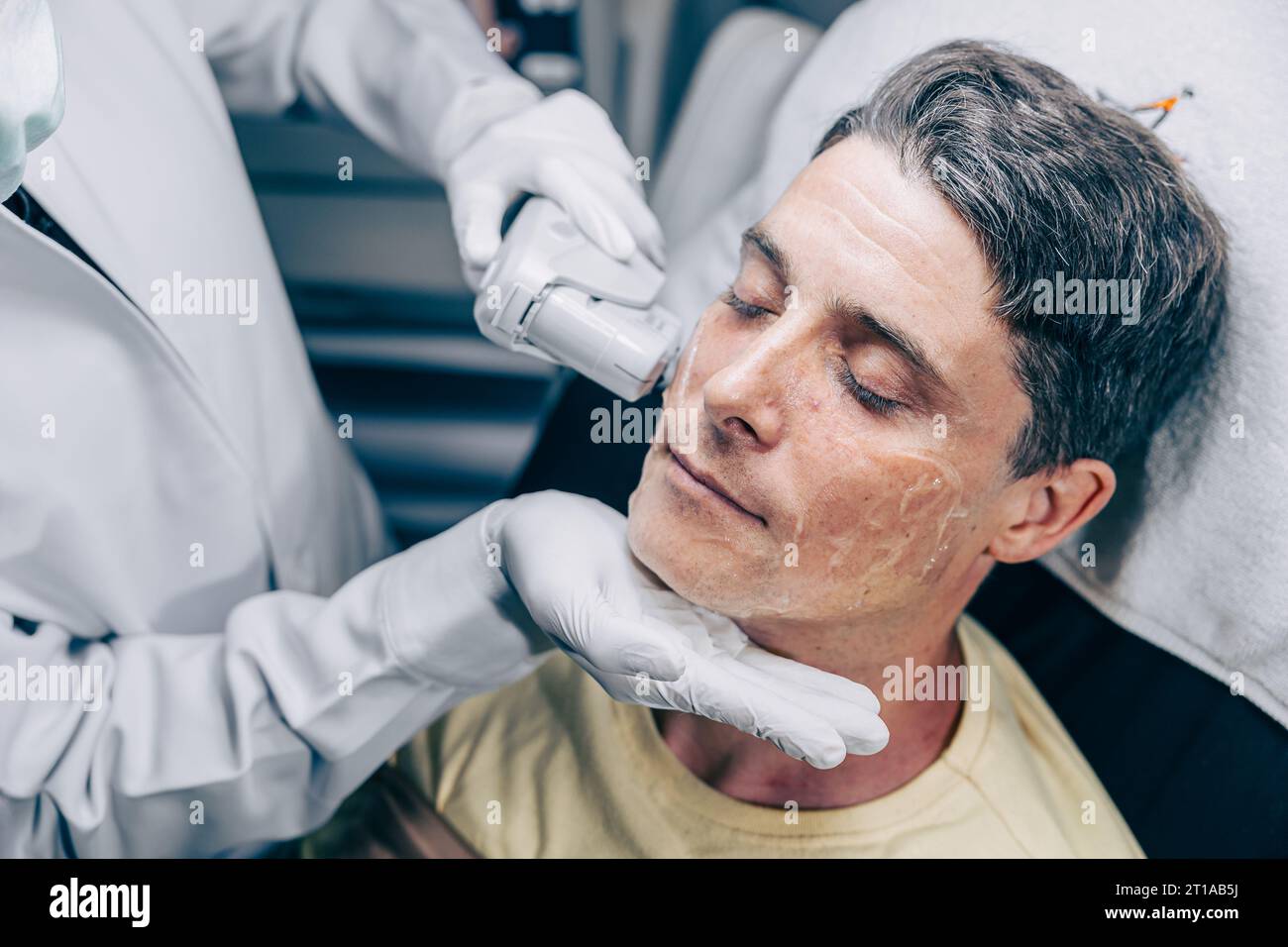 Hautarzt mit Laser-Resurfacing Gesichtshaut-Behandlungstechnologie mit erwachsenen Männern, um Falten und Narben in der Anti-Aging-Klinik zu reduzieren Stockfoto