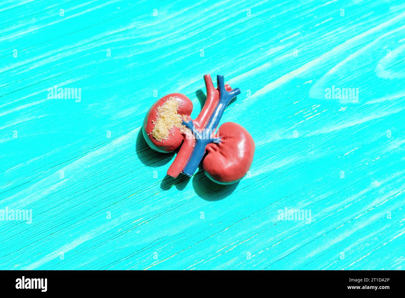 Detailliertes anatomisches Modell der menschlichen Nieren, das die Nierengesundheit und das Vorhandensein sandartiger Partikel vor blauem Hintergrund veranschaulicht. Stockfoto