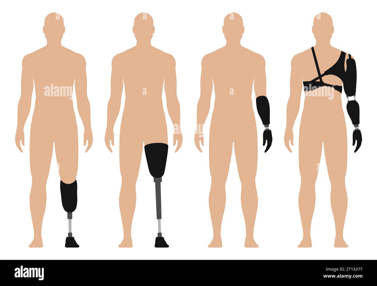 Mann mit Prothetik Arm und Bein, medizinische Vektor-Illustration Set, isoliert auf weißem Hintergrund. Stock Vektor
