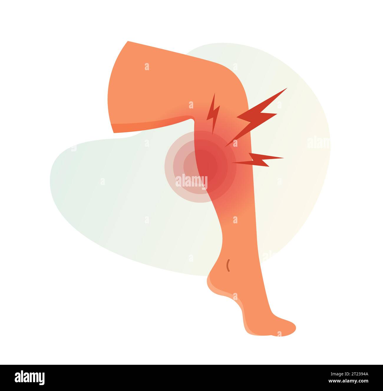 Wadenmuskelschmerzen – Krämpfe – Stock-Illustration als EPS 10 Datei Stock Vektor