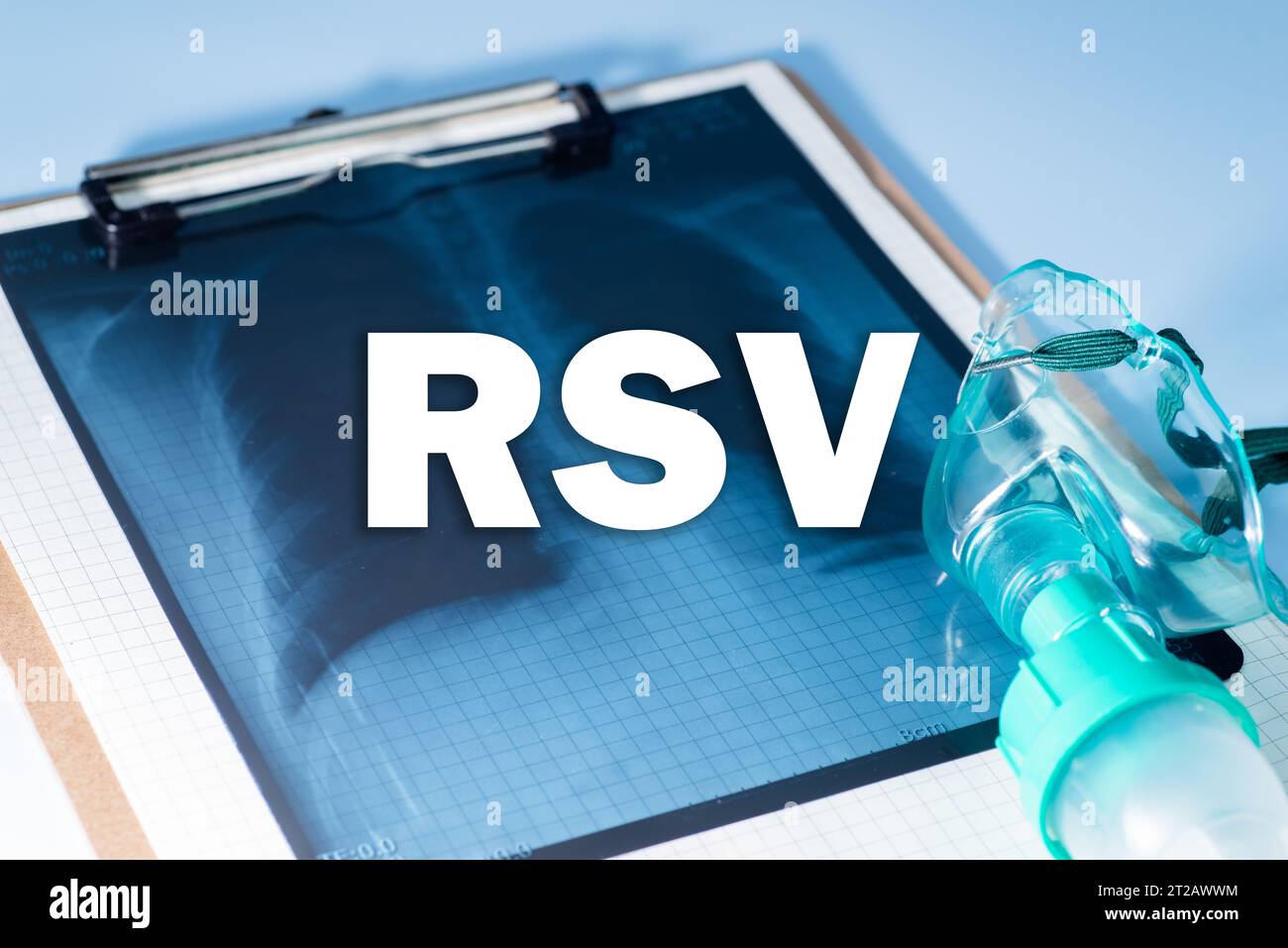 Hintergrund des Respiratory Syncytial Virus (RSV) und Thoraxröntgenuntersuchung, medizinisches Konzept Stockfoto