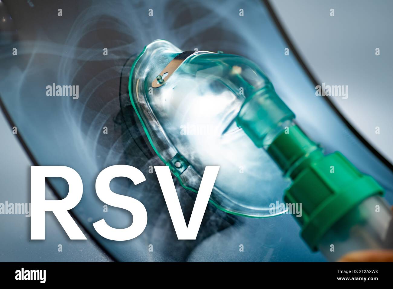 Hintergrund des Respiratory Syncytial Virus (RSV) und Thoraxröntgenuntersuchung, medizinisches Konzept Stockfoto