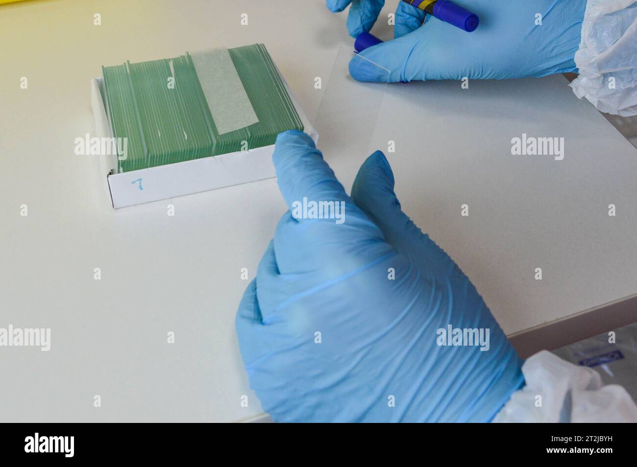 Die Objektträger für die mikroskopische zytologische Biopsieforschung. Stockfoto