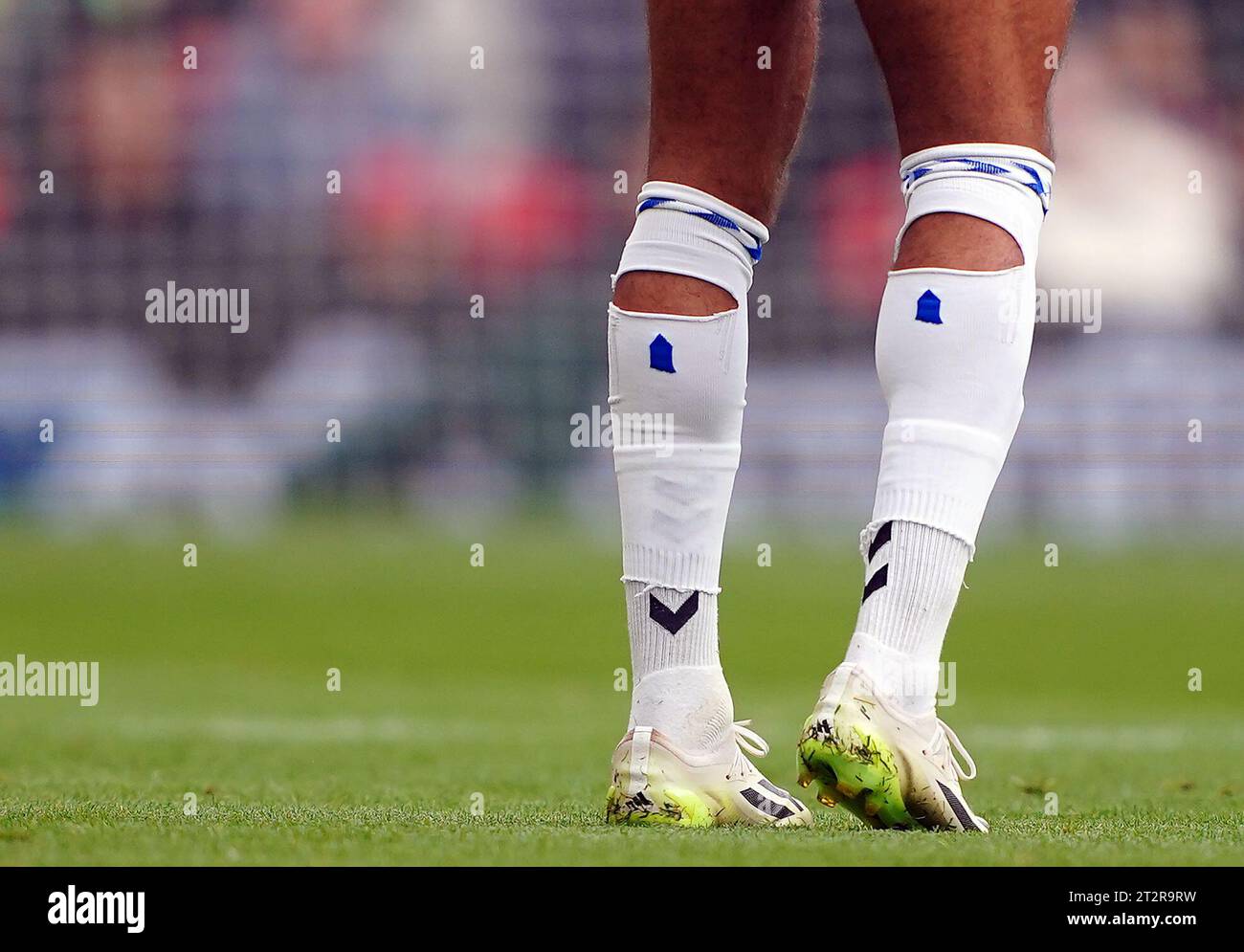 Löcher in die Socken von Everton's Dominic Calvert-Lewin während des Premier League-Spiels in Anfield, Liverpool. Bilddatum: Samstag, 21. Oktober 2023. Stockfoto