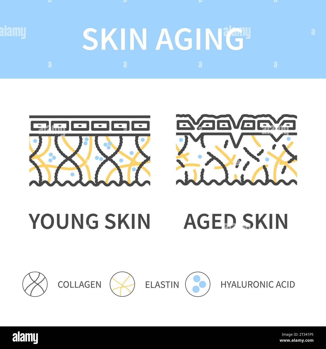 Querschnittsdiagramm der jungen und alternden Haut Stock Vektor