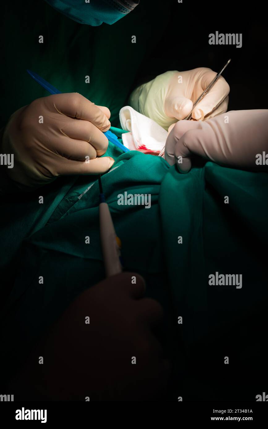 Nahaufnahme der Hände eines Chirurgen, der einen Hautschnitt in die Haut eines Patienten macht. Stockfoto