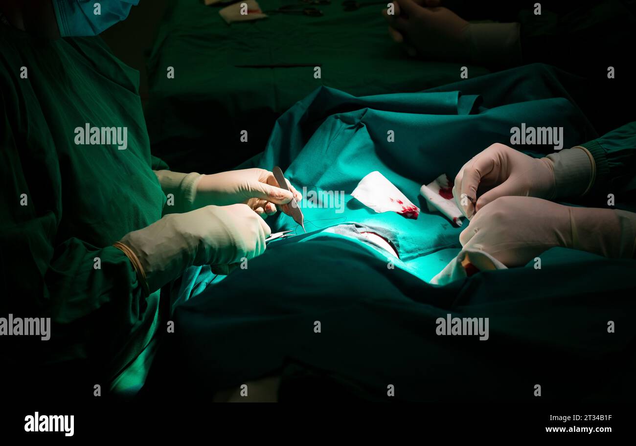 Nahaufnahme der Hände eines Chirurgen, die den Hautschnitt eines Patienten nähten. Stockfoto