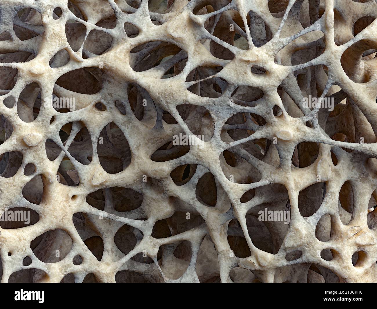 Realistische Knochenschwamm-Struktur Nahaufnahme, Knochenstruktur durch Osteoporose beeinflusst, 3D-Illustration. Knochengewebe durch Osteoporose geschädigt Stockfoto