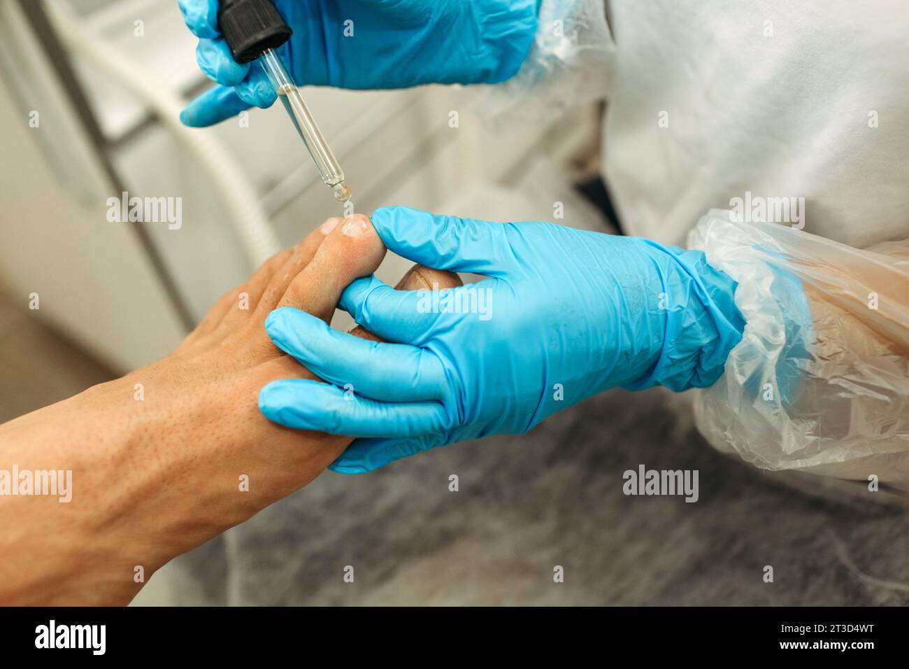 Ein Arzt lässt das Arzneimittel aus einer Pipette auf einen schmerzenden Finger fallen