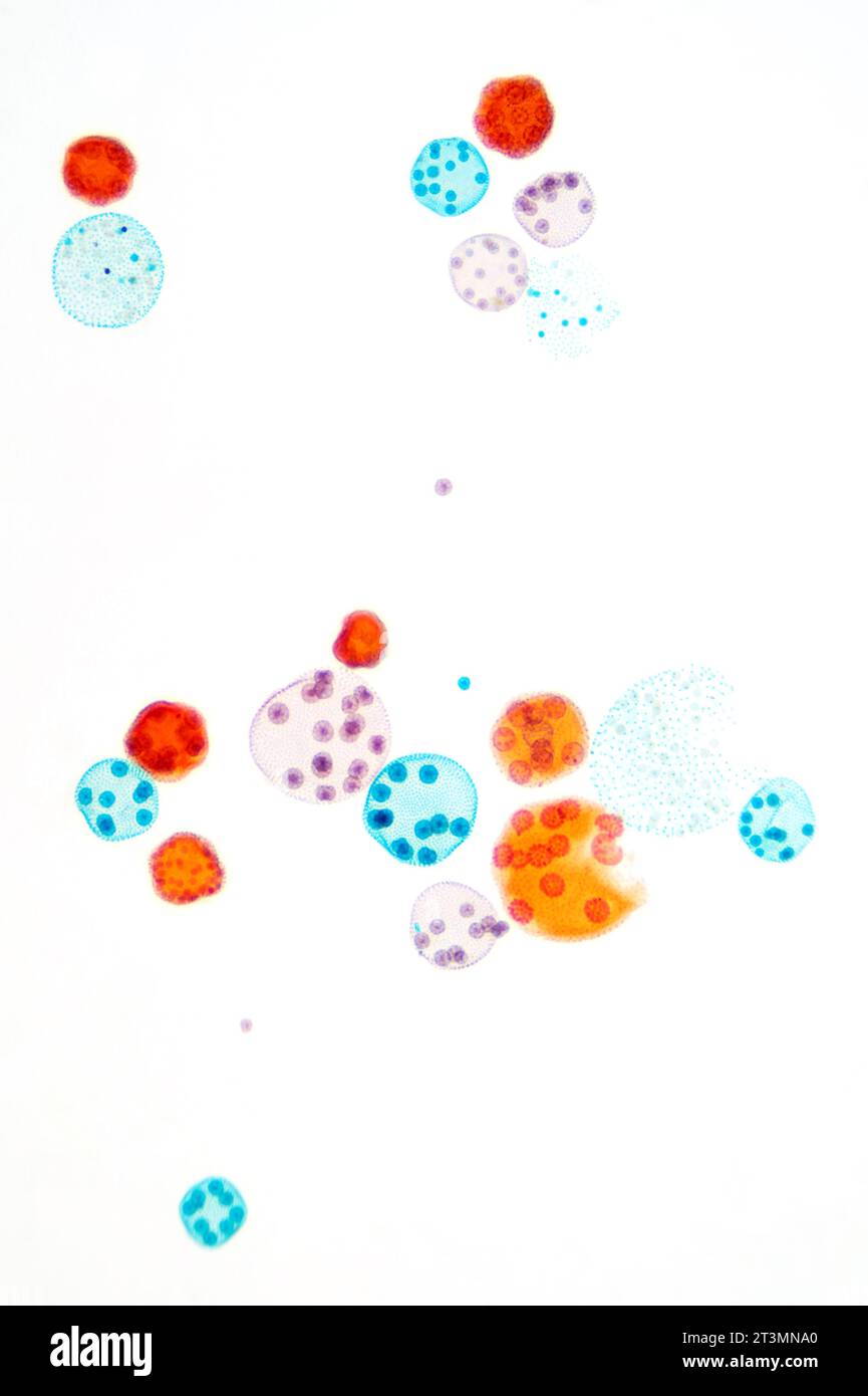 Volvox, grüne Algen, ganze Halterung, 8-facher Lichtmikrograph. Polyphyletische Gattung der Chlorophyten, grüne Algen, die kugelförmige Kolonien bilden, die als globale Algen bezeichnet werden. Stockfoto