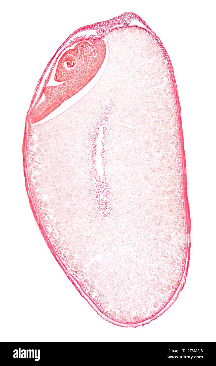 Weizenkorn, Querschnitt einer Vollkornbeere, 8-facher Lichtmikrograph. Rot gefärbtes Getreidekorn, bestehend aus Kleie, Endosperm und Keim. Stockfoto