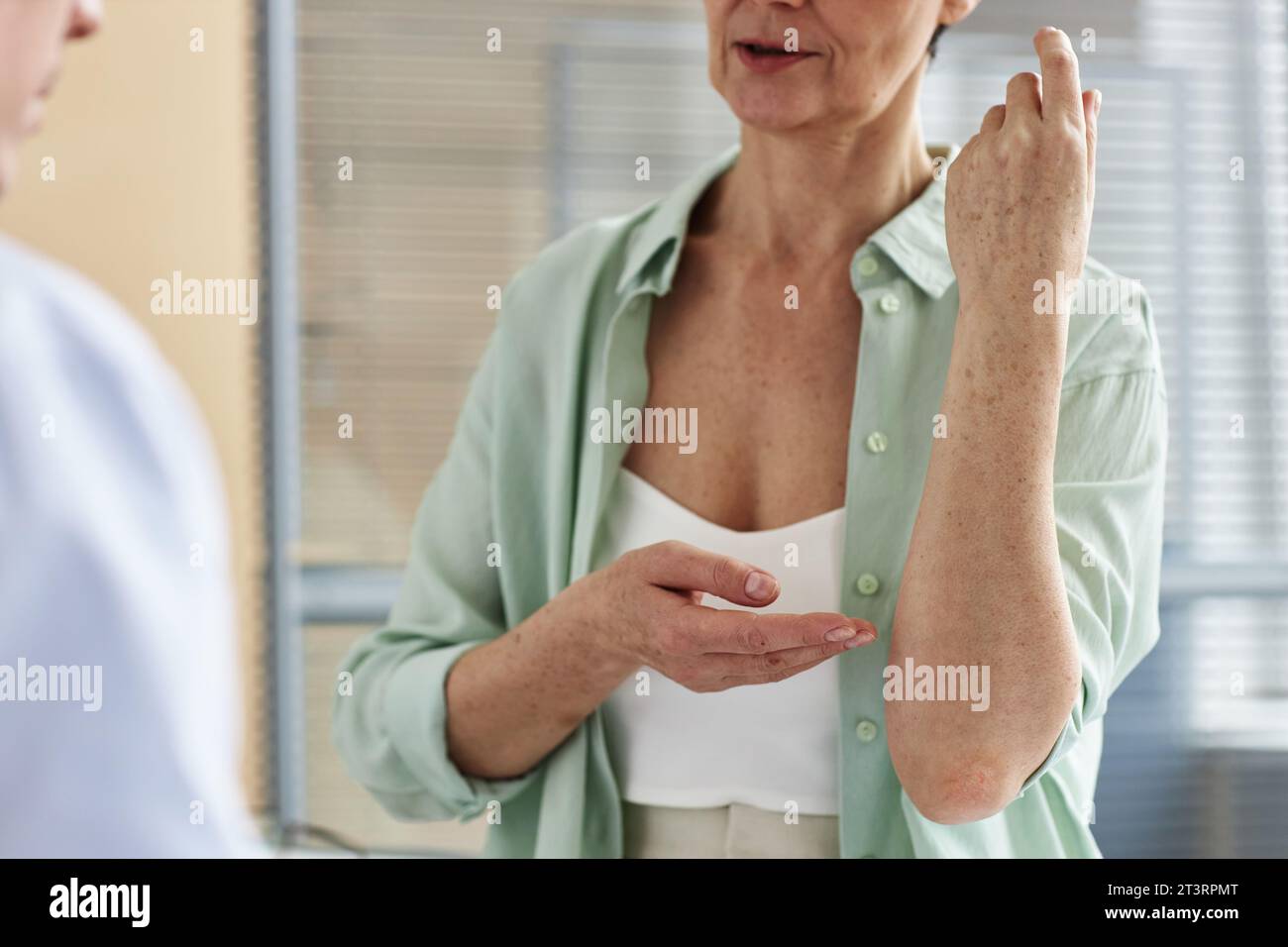 Nahaufnahme einer Reifen Frau mit Haut an Unterarmen während der Arztpraxis in der Dermatologischen Klinik, Kopierraum Stockfoto