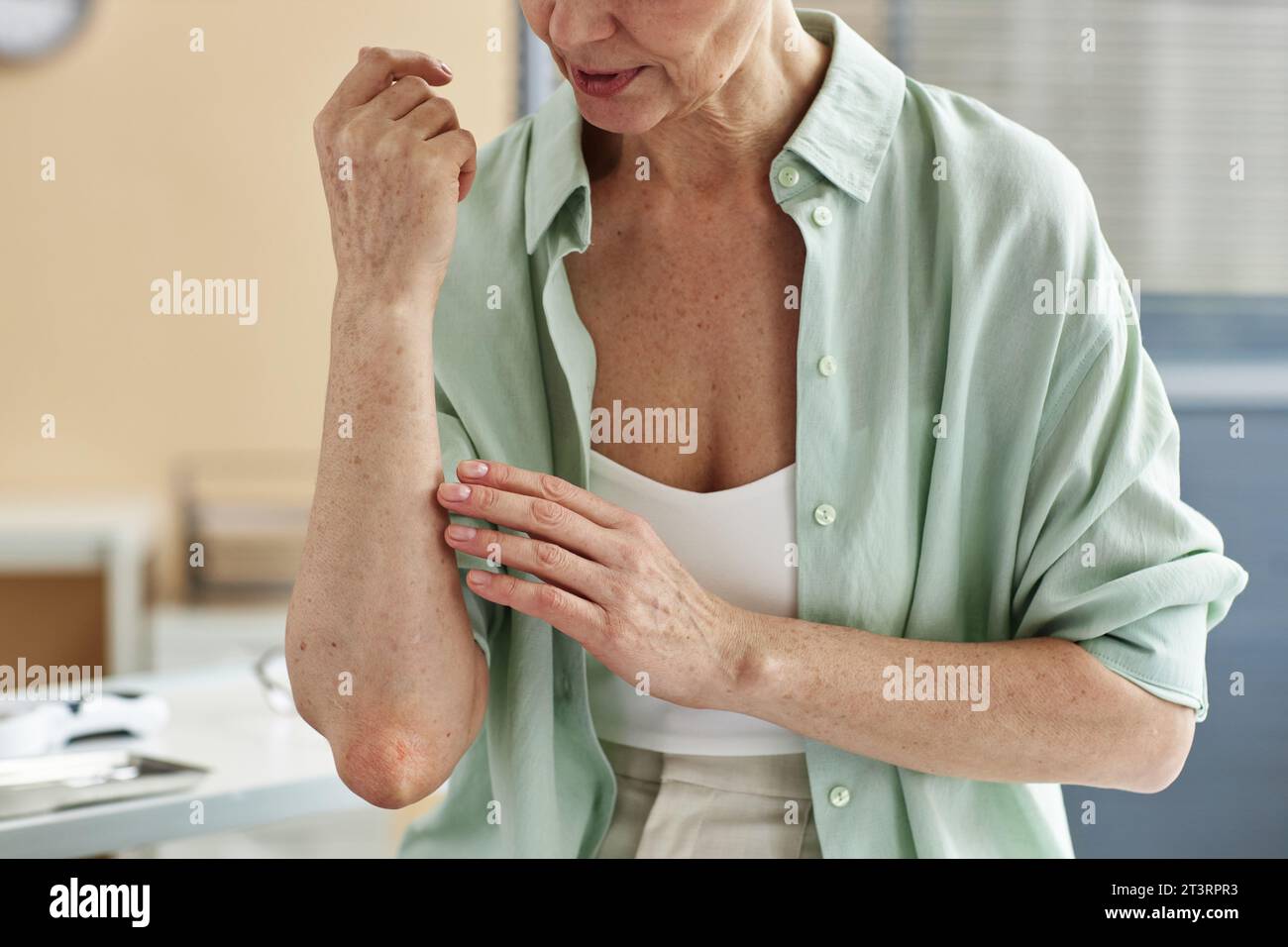 Nahaufnahme einer Reifen Frau mit Hautbeschwerden, die mit dem Arzt in der Dermatologie-Klinik spricht und auf den Unterarm zeigt, Kopierraum Stockfoto