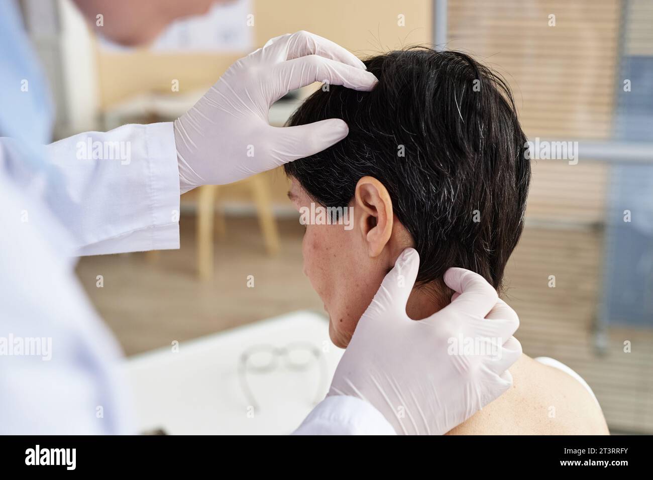 Nahaufnahme einer Arzthaltung zur Untersuchung von Kopf und Kopfhaut einer Patientin in der Dermatologischen Klinik, Kopierraum Stockfoto