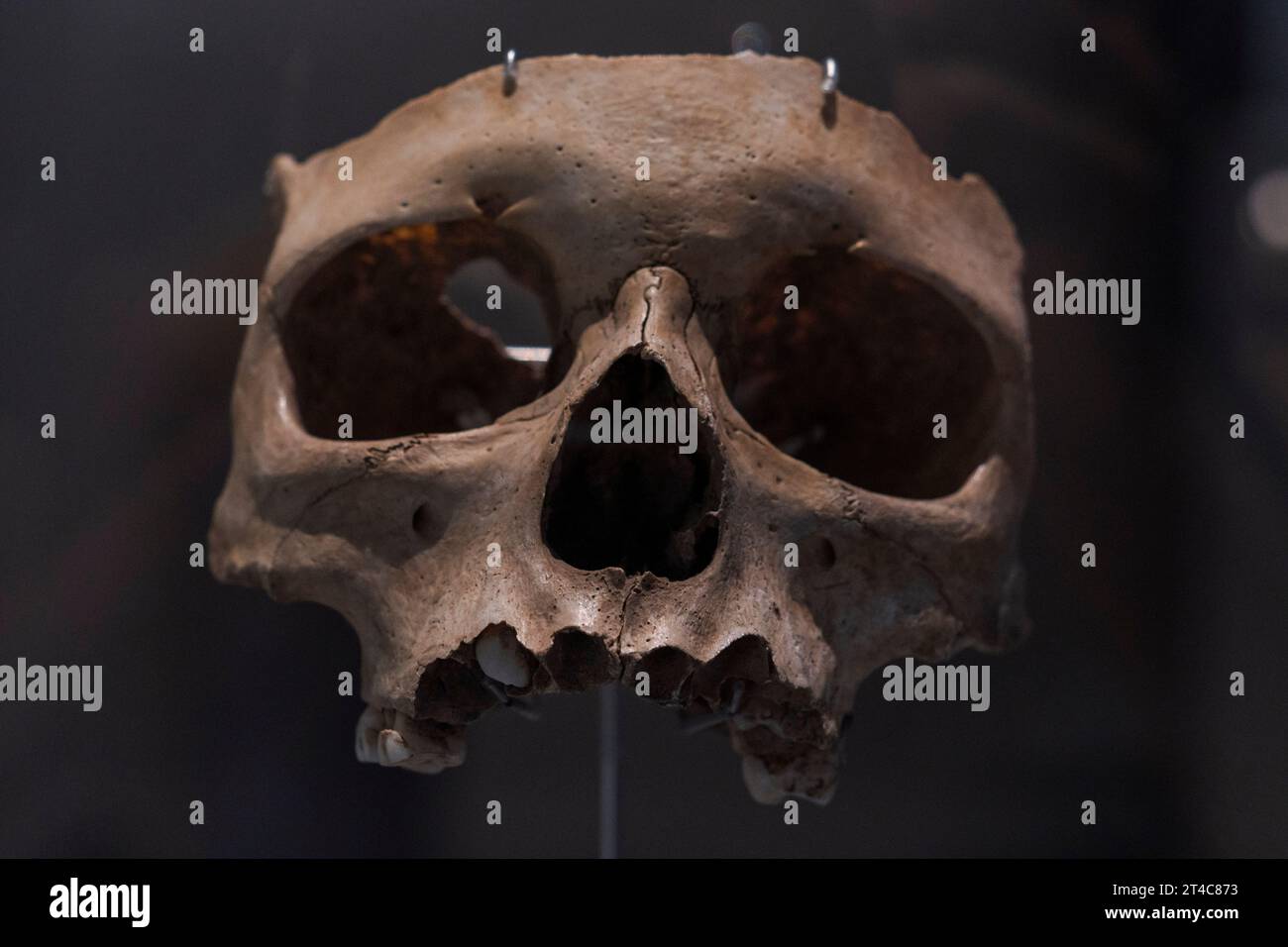 Infantiles splanchnocranium, Homo sapiens, Lower Magdalenian, El Pendo, Escobedo, Camargo, Museum für Urgeschichte und Archäologie (MUPAC), Santander, CAN Stockfoto