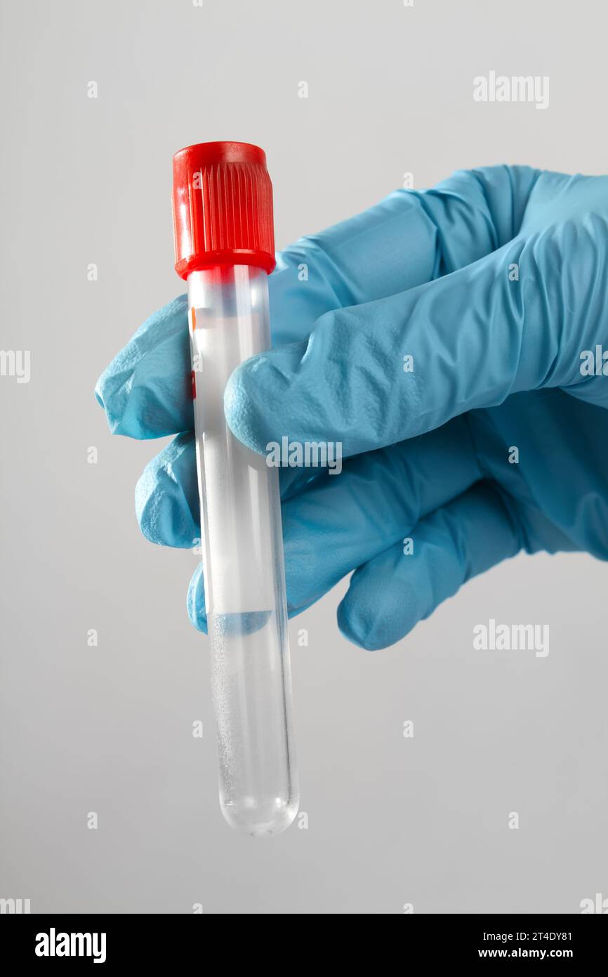 Die Hand eines medizinischen Facharztes in einem sterilen Handschuh hält ein sauberes Röhrchen mit rotem Blut Stockfoto