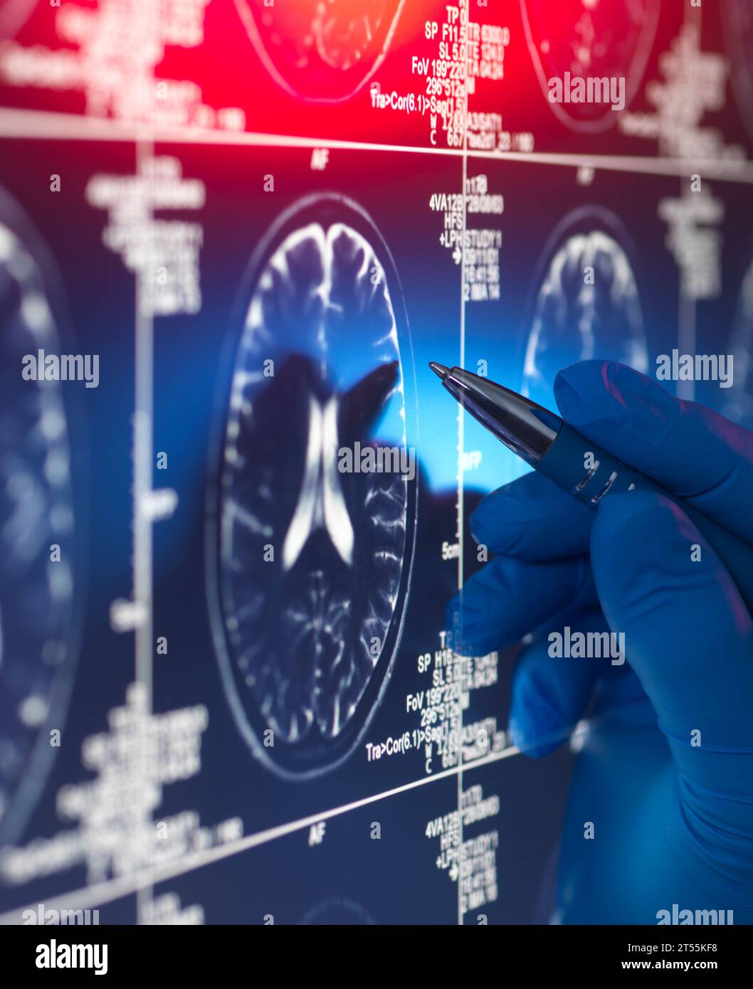 Arzt sieht einen Gehirnscan des Patienten auf dem Bildschirm an Stockfoto