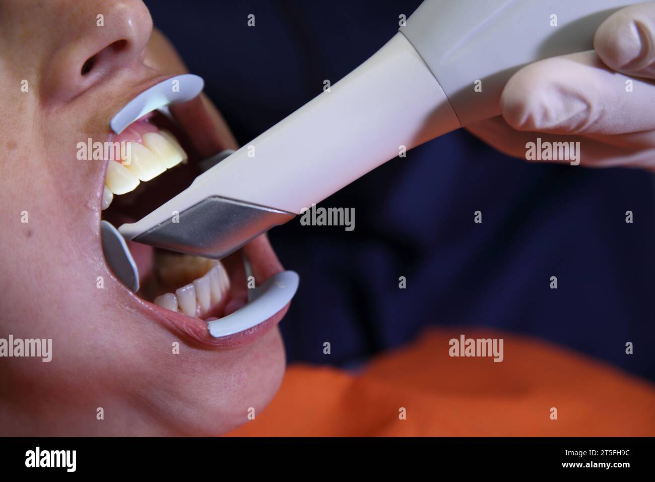 Zahnärztliche Praxis. Panorama-3D-Dentalscan. Der Zahnarztarbeitsplatz. Junge Frau, die Zahnarzt in der Klinik besucht. Männlicher Zahnarzt mit Patient in der Klinik. Stockfoto