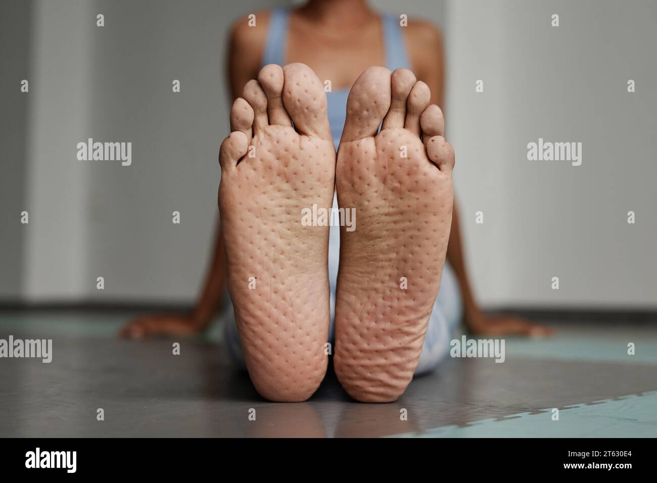 Vorderansicht weiblicher Füße mit Nagelbrettmarkierungen im Yoga-Studio, Kopierraum Stockfoto