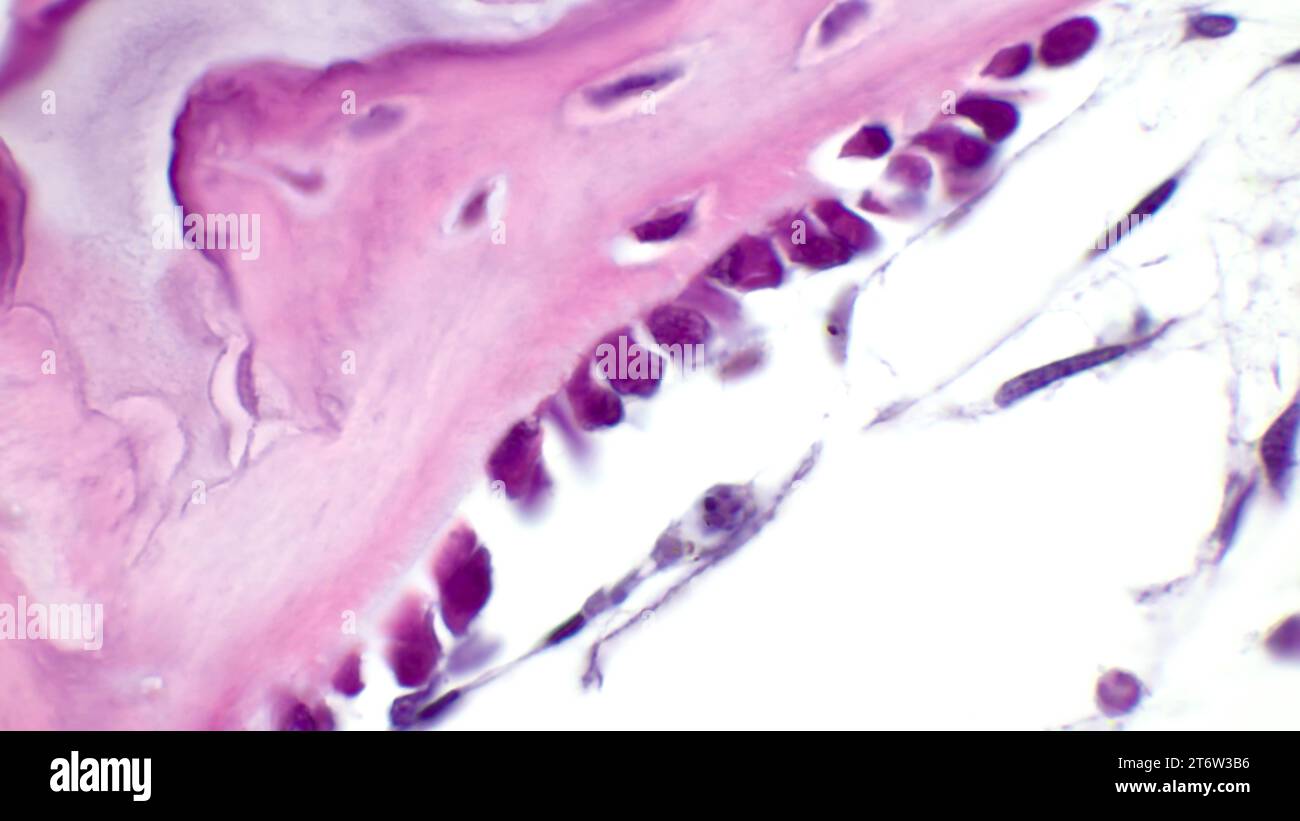 Lichtmikrogramm intramembranöser Ossifikation. Knochentrabekeln werden durch Osteoblasten gebildet, die ihre Oberfläche auskleiden. Hämatoxylin- und Eosin-Färbung Stockfoto