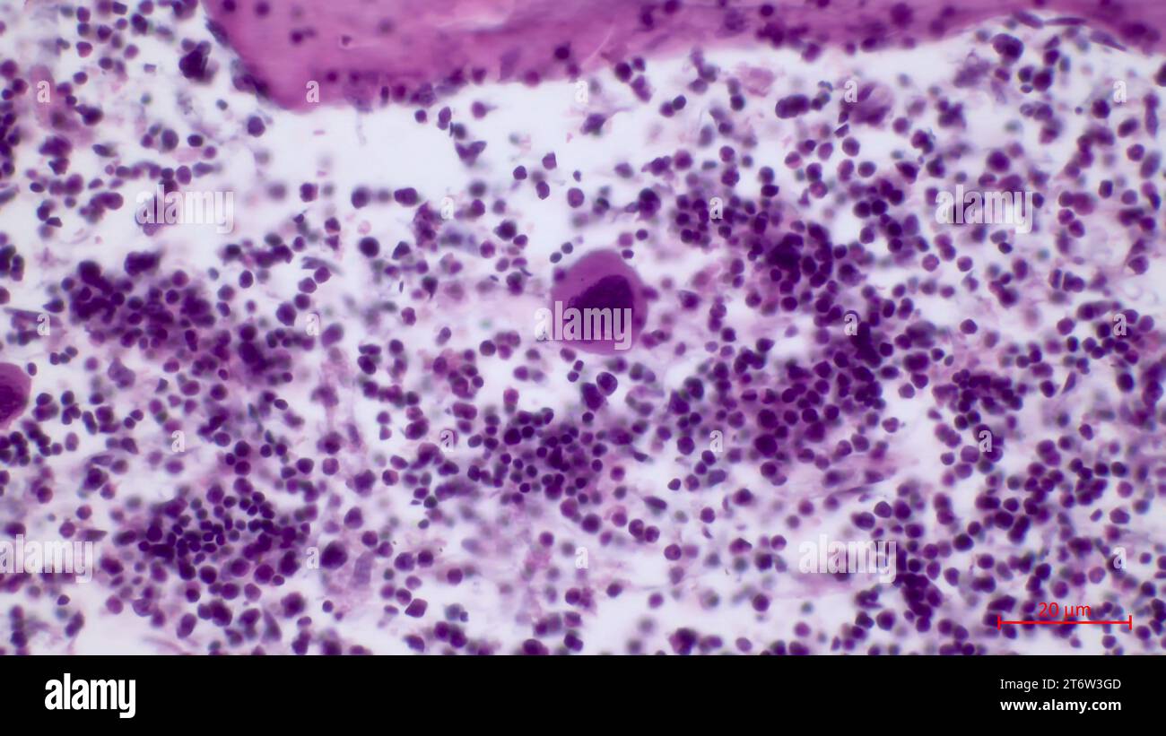 Mikroskopische Struktur der Histologie des roten Knochenmarks. Die größte Zelle im roten Knochenmark ist der Megakaryozyten (im Zentrum). Stockfoto