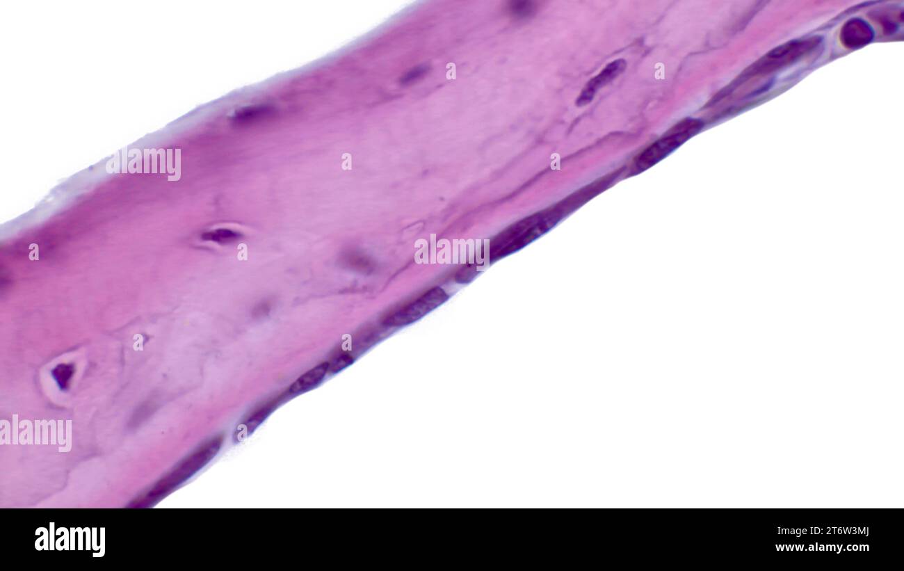 Lichtmikrogramm intramembranöser Ossifikation. Knochentrabekeln werden durch Osteoblasten gebildet, die ihre Oberfläche auskleiden.Hämatoxylin und Eosin Färbung Stockfoto