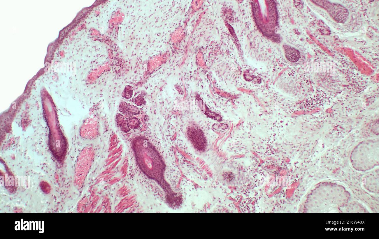 Jedes Augenlid (oder Tarsus) besteht aus einer dünnen Gewebehülle, die das Auge schützt, indem sie die Hornhaut bedeckt. Hämatoxylin-endEosin-Färbung. Stockfoto