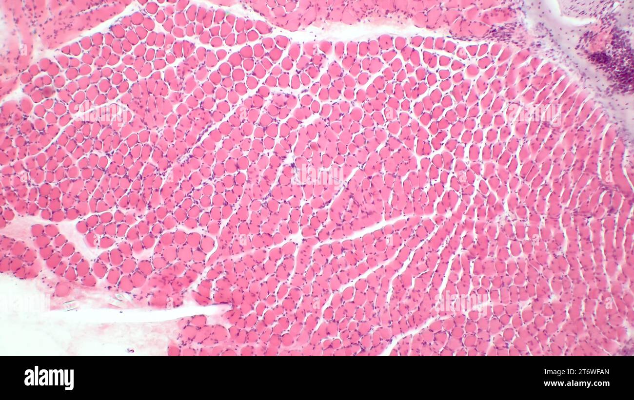 Mikroskopische Struktur des Skelettmuskelgewebes. Сross Abschnitt der Muskelfasern. Hämatoxylin-endEosin-Färbung. Vergrößerung: x200 Stockfoto