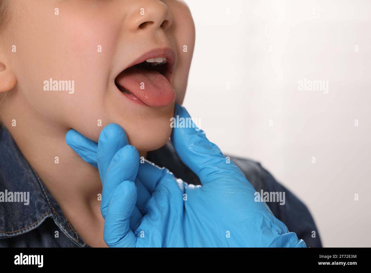 Doktor im medizinischen Handschuh, der die Mundhöhle des Mädchens auf hellgrauem Hintergrund untersucht, Nahaufnahme. Leerzeichen für Text Stockfoto