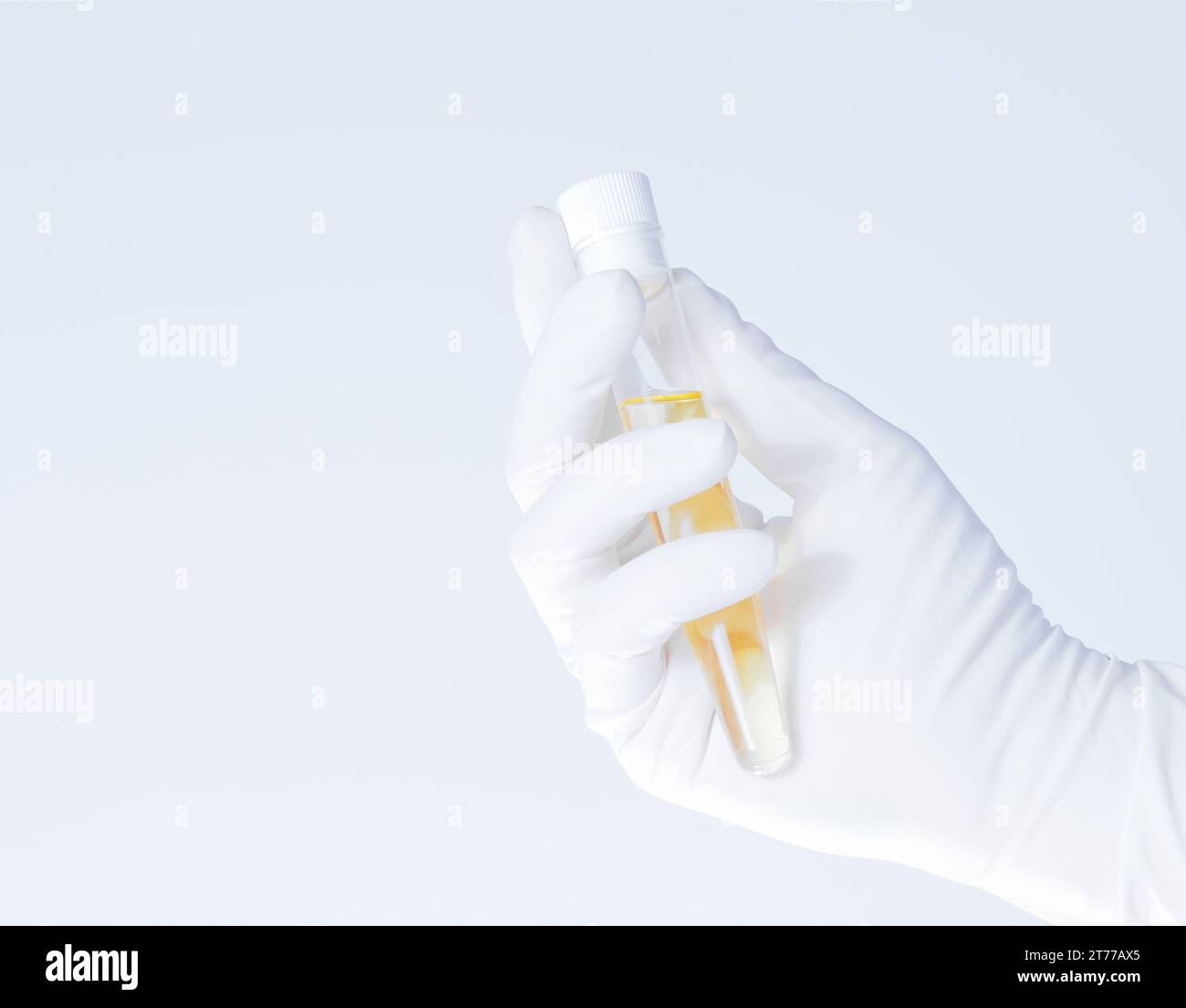 Nahaufnahme einer Glasröhre mit gelber Flüssigkeit in der Wissenschaftlerhand während der medizinischen Prüfung auf weißem Hintergrund Stockfoto
