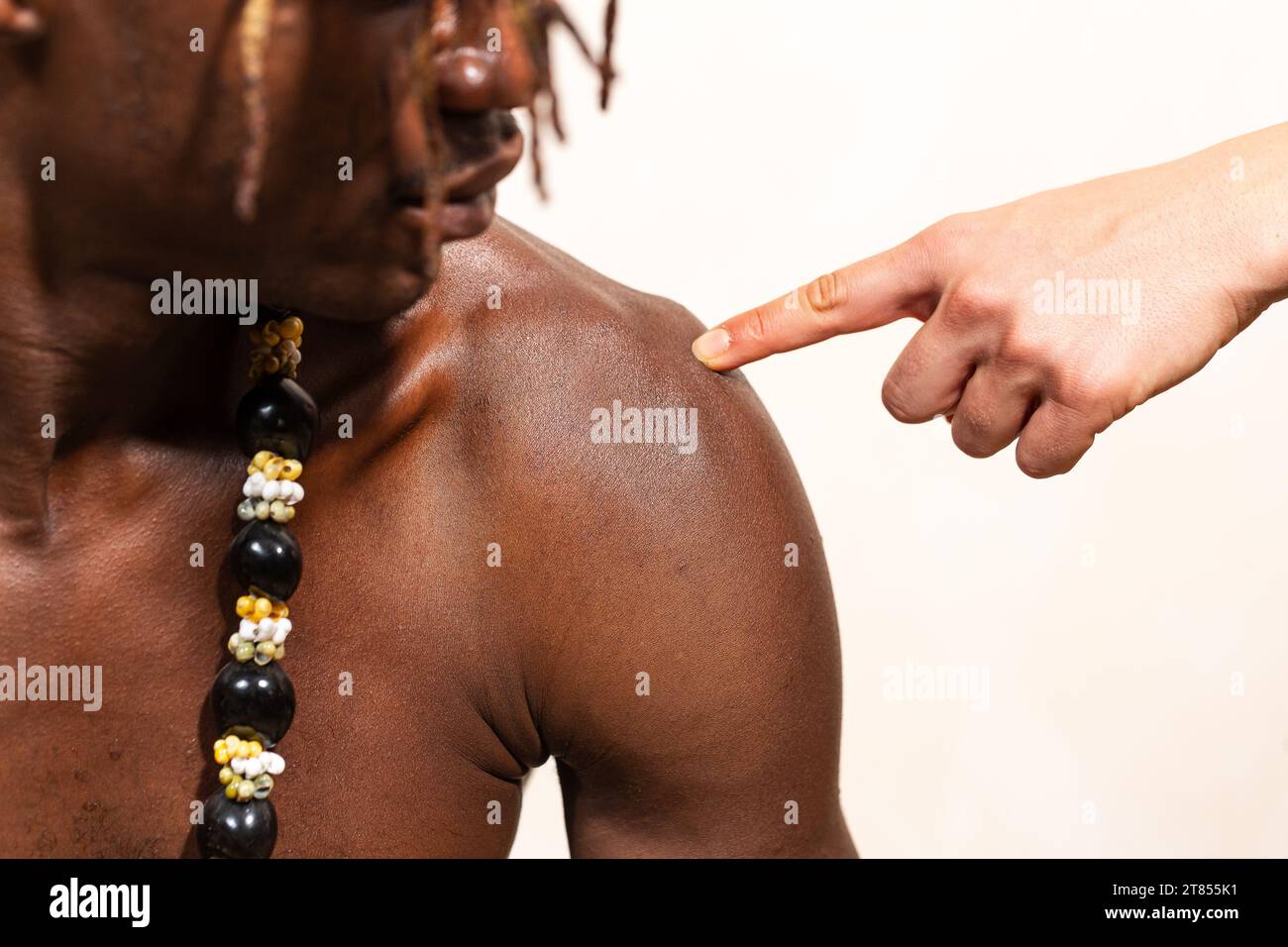 Konzept der Akromionpathologie mit entzündungsbedingten Schulterschmerzen. Die Hand einer Ärztin zeigt auf die Rotationskapsel eines afrikanischen Mannes. Stockfoto