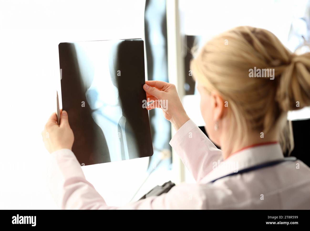 Röntgenfilme der Frau in der Hand halten Röntgenbilder aganistischer Krankenhaushintergrund. CT-Scans des Knochengesundheitskonzepts. Stockfoto