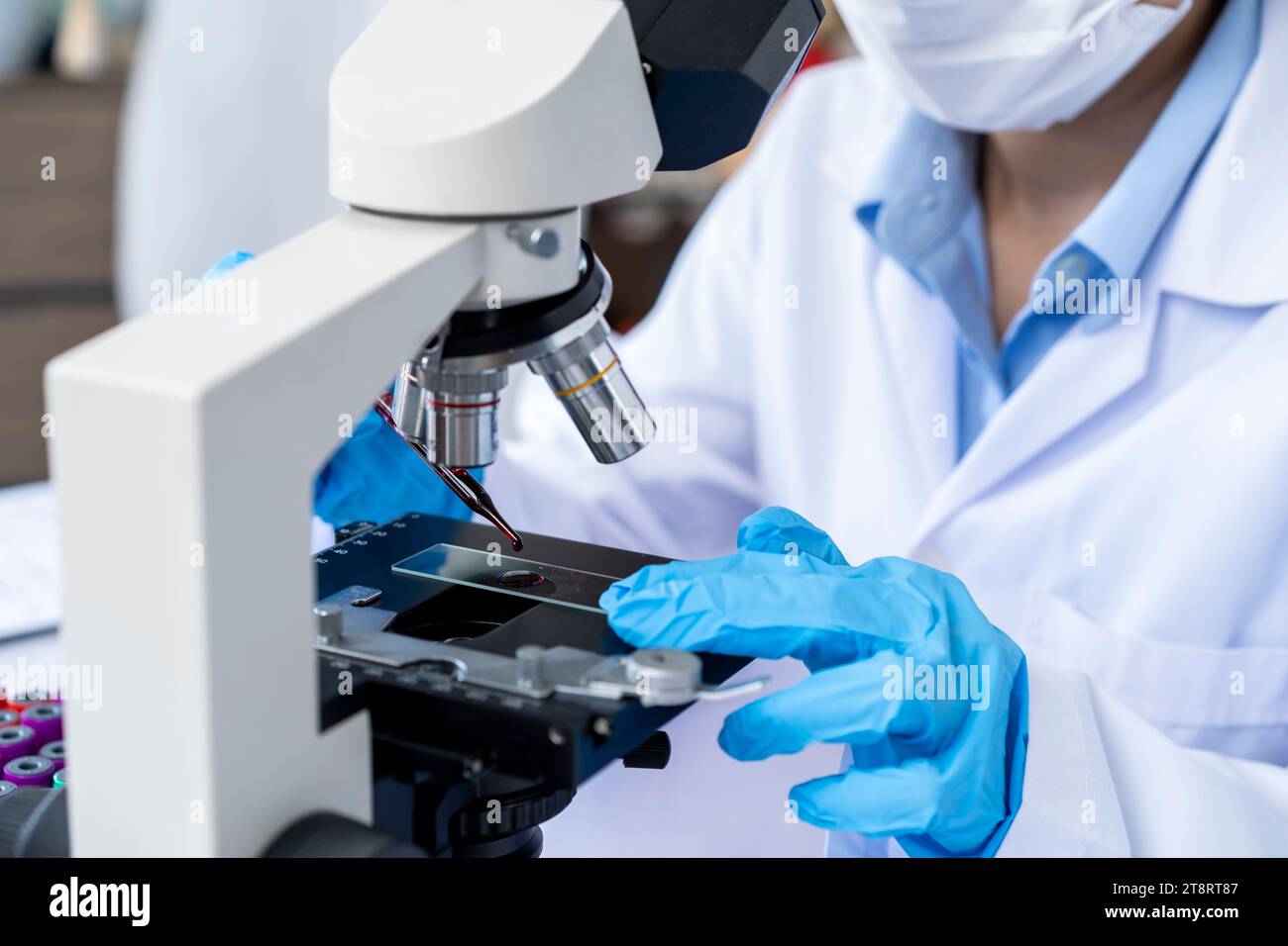 Arzneimittelforschung im Chemielabor, der Bluttröpfchen für die mikroskopische Untersuchung Stockfoto