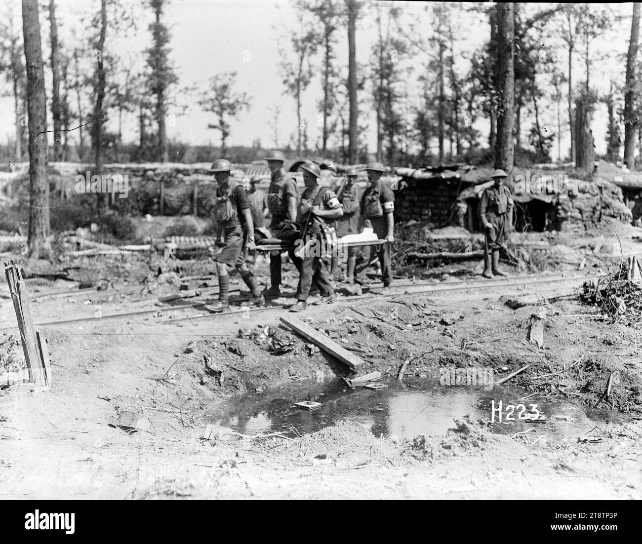 In Ploegsteert Wood, im Ersten Weltkrieg, tragen Trageträger einen verwundeten Soldaten auf einer Trage auf einem Feldweg in Ploegsteert Wood nahe der Westfront. Im Hintergrund befinden sich neuseeländische Einbauten. Im Vordergrund befindet sich ein großes Muschelloch, das mit Wasser gefüllt ist. Foto aufgenommen 1917 Stockfoto