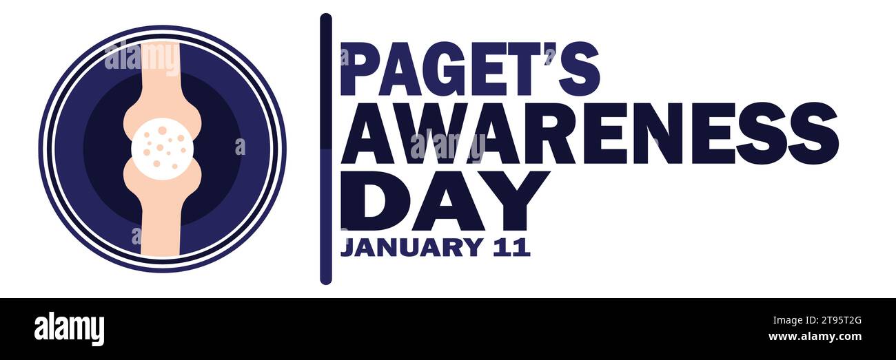Paget's Awareness Day. Vektorabbildung. Januar: Urlaubskonzept. Vorlage für Hintergrund, Banner, Karte, Poster mit Textbeschriftung. Stock Vektor
