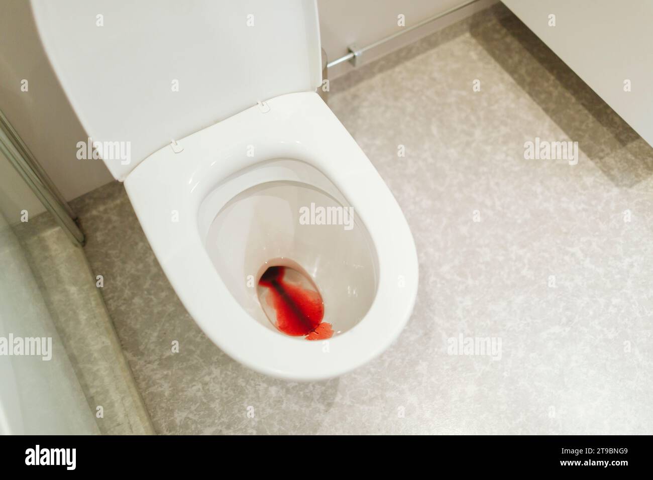 Die Toilettenschüssel war mit Blut dreckig Stockfoto