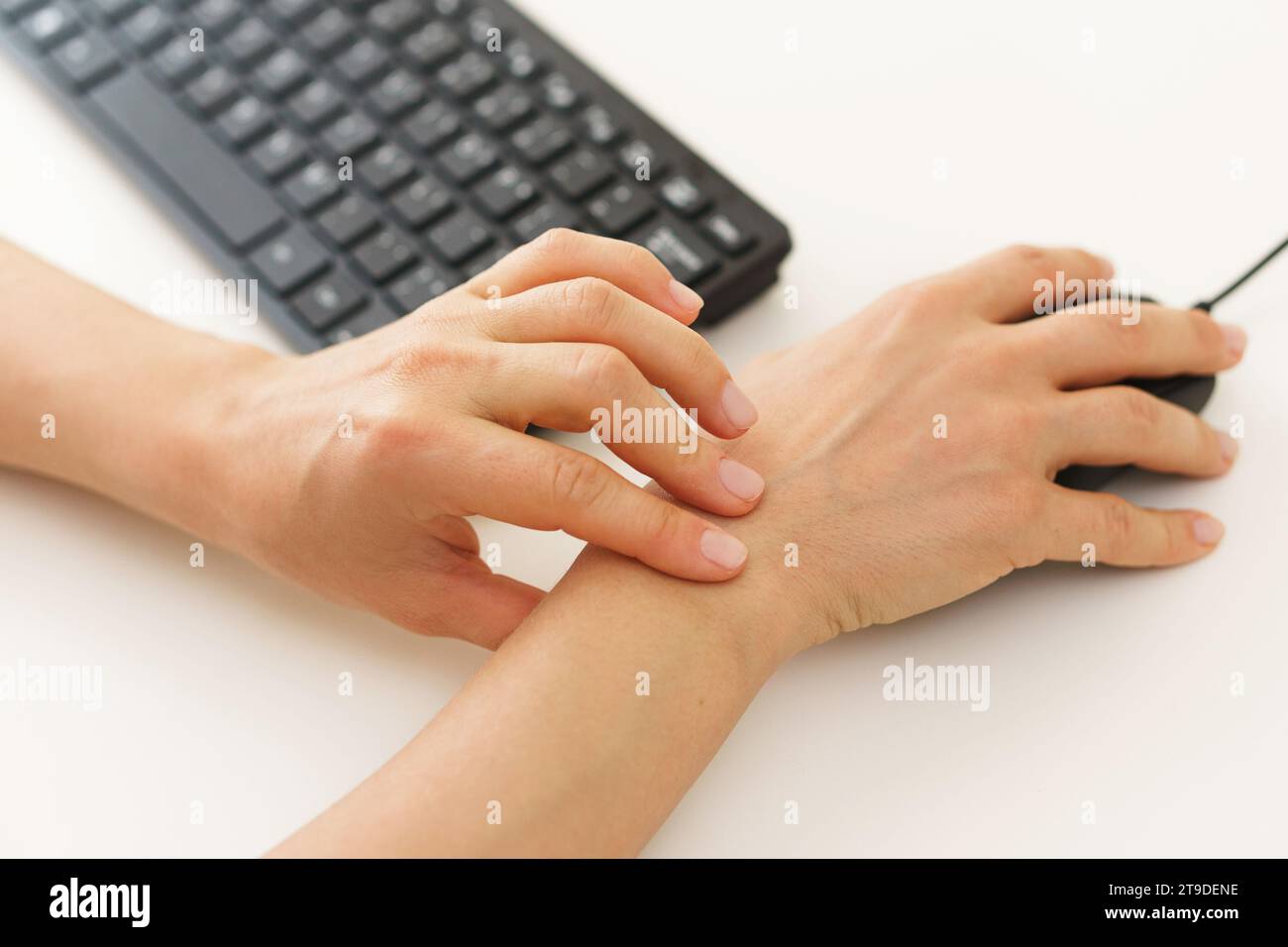 Nahaufnahme weiblicher Hände mit Schmerzen im Handgelenk wegen Karpaltunnelsyndrom Stockfoto