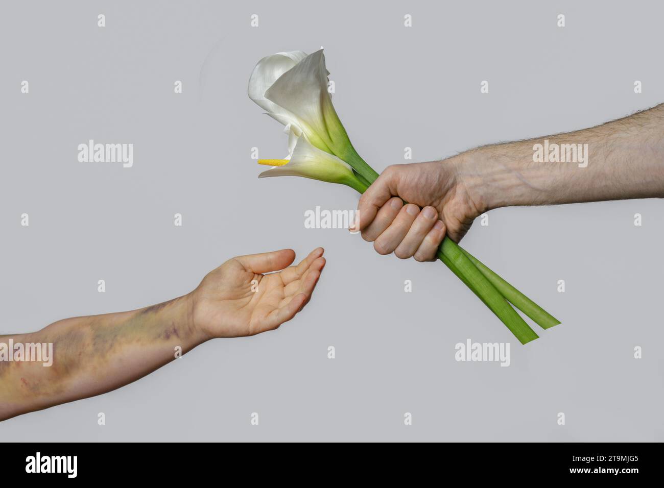 Männliche Hand mit weißer Lilienblüte und weibliche Hand mit blauen Flecken auf grauem Hintergrund. Autounfallnarbe, Lungenembolie-Behandlung oder häuslich Stockfoto