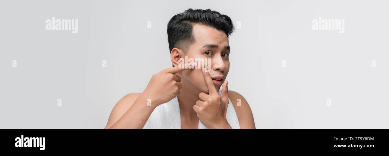 Nahaufnahme Kopfschuss unglücklicher Mann, der in den Spiegel blickt, sich von empfindlicher Haut oder Akneausbruch belastet fühlt Stockfoto