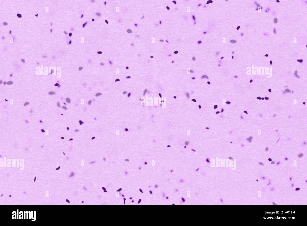 Bakterien oder Keime Mikroorganismus Zellen unter Mikroskop in der Farbe chemische rosa Flüssigkeit, verlangsamt Stockfoto