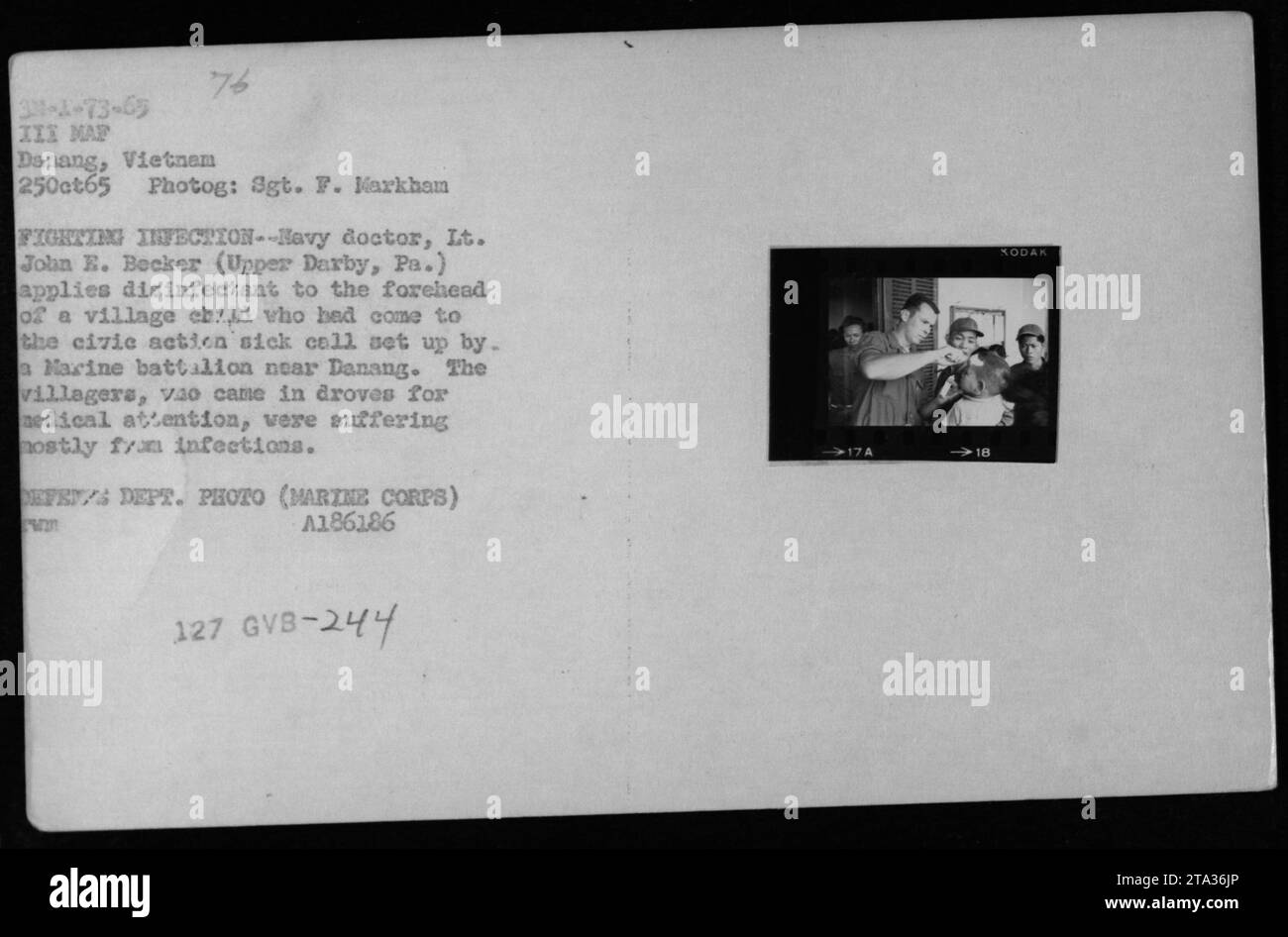 Navy Doctor, Lt. John E. Becker, gibt Desinfektionsmittel auf die Stirn eines Dorfkindes bei einem Bürgeraktion Krankenruf in der Nähe von Danang. Das Kind und viele andere Dorfbewohner suchten wegen verschiedener Infektionen ärztliche Hilfe beim Marinebataillon. Foto von Sgt. F. Markhand, aufgenommen am 25. Oktober 1965. Stockfoto