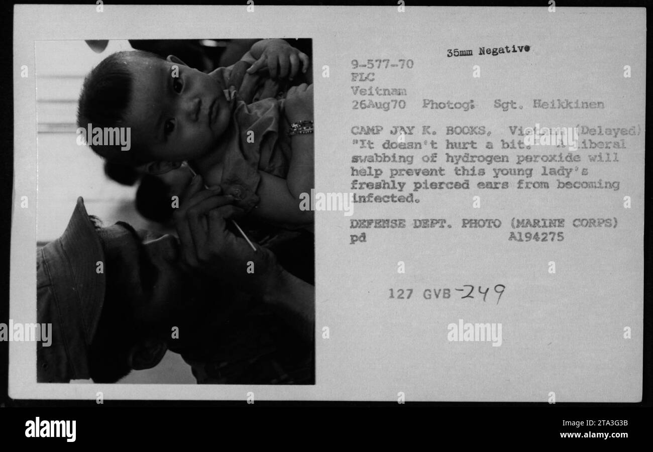 Medizinisches Personal, das am 26. August 1970 eine Ohrstechoperation für eine junge Dame im Camp Jay K. Books in Vietnam durchführte. Wasserstoffperoxid wird angewendet, um Infektionen zu verhindern. Dieses Foto stammt aus der Sammlung amerikanischer Militäraktivitäten während des Vietnamkriegs. Stockfoto