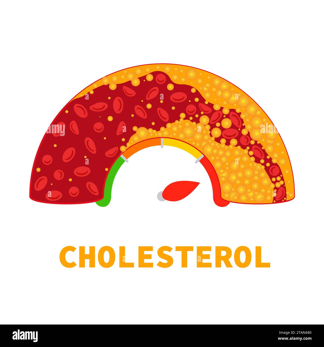 Cholesterinspiegel, konzeptuelle Darstellung. Stockfoto