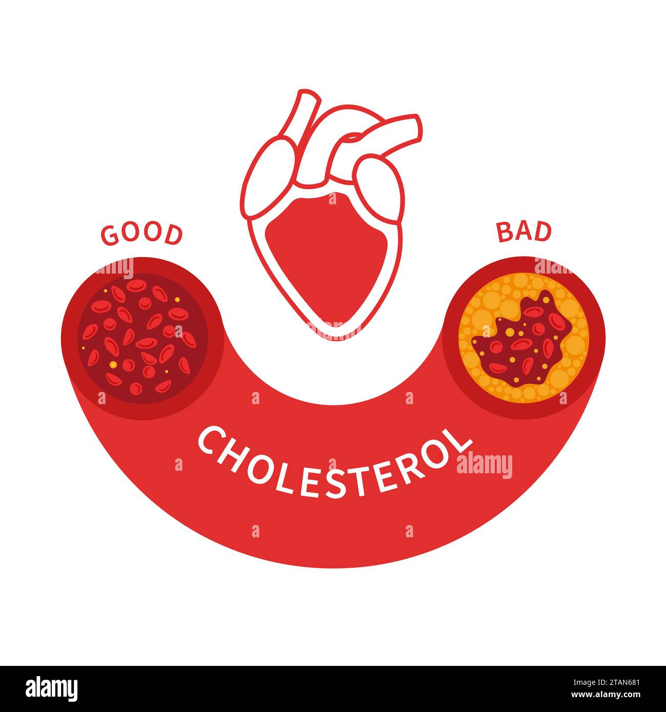 Cholesterinspiegel, konzeptuelle Darstellung Stockfoto