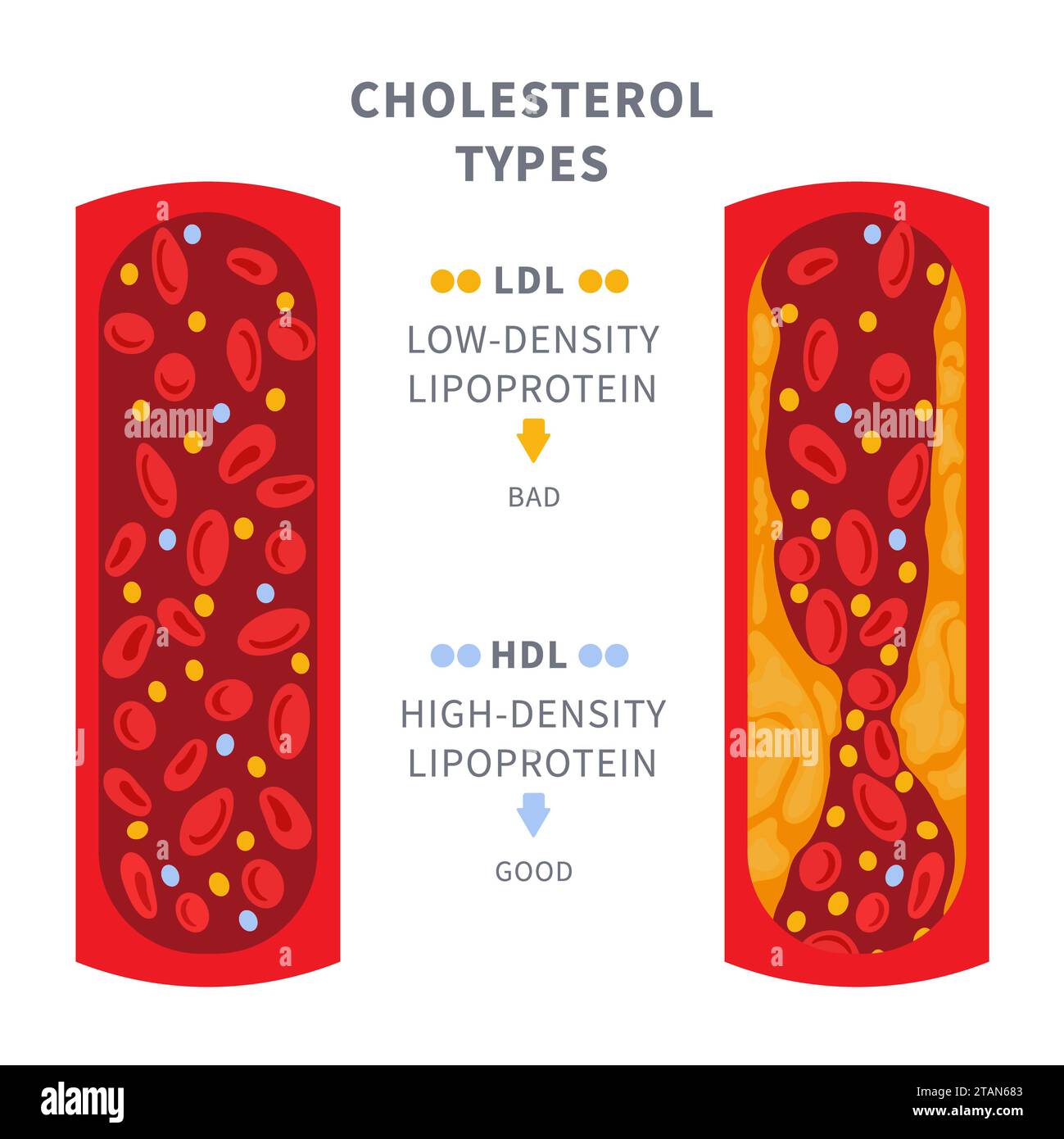 Cholesterinspiegel, konzeptuelle Darstellung Stockfoto
